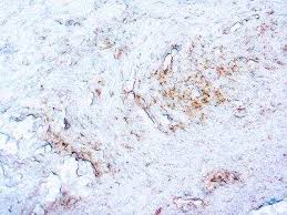 Image result for Treponema