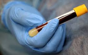 Gerardo mora/getty images news/getty images. How To Improve Your Blood Lab Draw