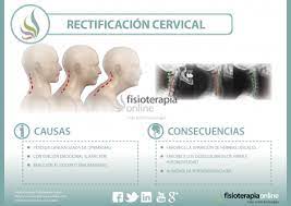 Entre los síntomas habituales de las dolencias cervicales podemos citar no solo los dolores, si no también la sensación de hormigueo, mareos, vértigos, etc. La Rectificacion Cervical Que Es Y A Que Se Debe Esta Disfuncion