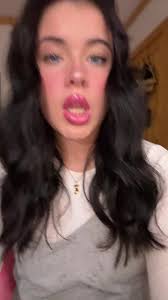 What Happened to Liliu Rice Face