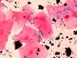 Fun With Microbiology What S Buggin You Bacterial Vaginosis Bacterial Vaginosis Microbiology Lactobacilli