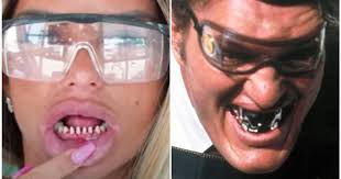 Katie price unveils her new teeth after second visit to turkey to fix her veneers katie price has unveiled her new teeth after jetting to turkey for the. Katie Price Compares Herself To James Bond Villain Jaws As She Gets Teeth Replaced Huffpost Uk