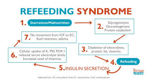 Image result for Refeeding Syndrome