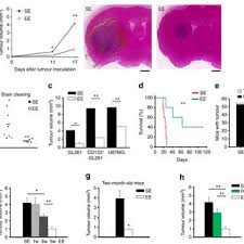 La planification familiale, ou le planning familial, est l'ensemble des moyens qui concourent au contrôle des naissances, dans le but de permettre aux familles de choisir d'avoir un enfant. Pdf Enriched Environment Reduces Glioma Growth Through Immune And Non Immune Mechanisms In Mice