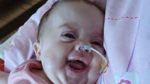 Scarlett's second chance: Brain damaged baby who survived against the odds  battles to come home