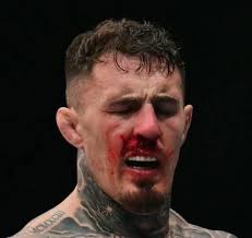 UFC fighter aspinall quits after accident