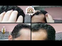 نتيجة خلطة الشيب على الشعر قبل بعد تجربة عملي داخل الفيديو علاج الشيب المبكر بدون حنا Youtube Hair Healthy Living Wearable