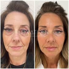 Fixation Skincare and Laser Clinic