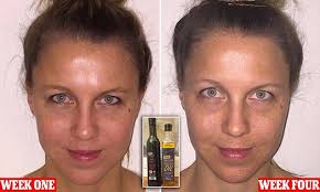 Can Olive Oil Help You Fight Wrinkles Fight Wrinkles Look Younger Wrinkles