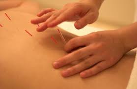Acupuncture Vitalia