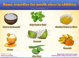 These are called stomach or peptic ulcers. 7 Home Remedy For Mouth Ulcer In Children During Summers Ulcer Remedies Mouth Mouth Ulcers Home Remedies