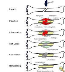 A bone of the shoulder that joins the sternum (breastbone) and the scapula (shoulder blade) coccyx. Activity 5 2 3 Bone Remodeling And Repair