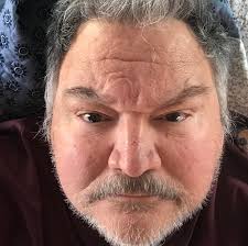 MG model yellowing after 2 years