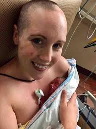 Mum, 32, who delayed skin cancer treatment to save unborn twins dies 10  months after giving birth