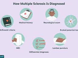 Recommended diagnostic criteria for multiple sclerosis: How Multiple Sclerosis Is Diagnosed