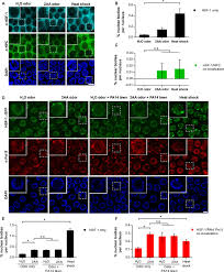 View newtown square recently sold homes and information about the newtown square, pa real estate market. Olfactory Learning Primes The Heat Shock Transcription Factor Hsf 1 To Enhance The Expression Of Molecular Chaperone Genes In C Elegans Biorxiv