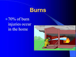 You can twist the detector off the wall or ceiling counterclockwise (or turn to the left. Burns 70 Of Burn Injuries Occur In The Home Prevention Smoke Alarms Candles Xmas Pan Placement On Stoves Fire Extinguisher Care Around Flammable Products Ppt Download