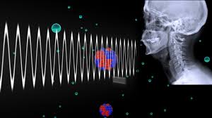Curious Kids How Do X Rays See Inside You