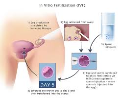 We did not find results for: 7 Perkara Yang Anda Ingin Tahu Tentang Rawatan Ivf Di Malaysia