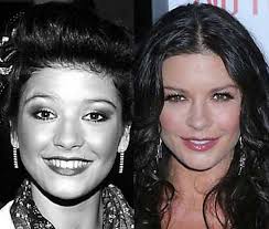 Catherine Zeta Jones Celebrity Surgery Celebrity Plastic Surgery Plastic Surgery