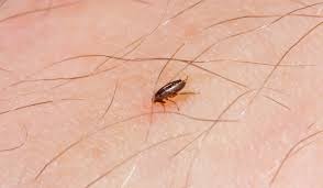 Image result for flea bites