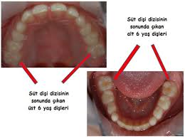Cocuklarda 6 Yas Disi Ado Ankara Dishekimleri Odasi