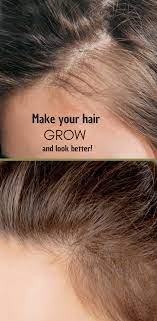Make Your Hair Look Better Hair Treatment Hair Therapy Hair Regrowth Treatments