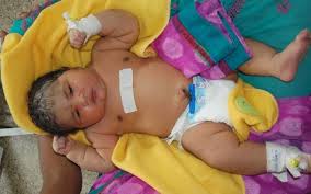 mum gives birth to heaviest baby in india weighing 15lb