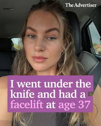 This woman has joined a growing trend of women in their 20s and 30s who are  looking to get facelifts to feel “fresh and snatched”  👉https://bit.ly/41VvwUX