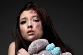 Therefore it works far better on bruises than dry heat. How To Get Rid Of Bruises Fast Top 10 Home Remedies To Heal A Bruise Dosplash