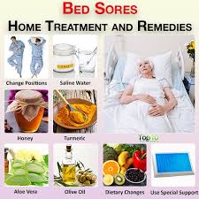 In this short video, i review why ppis are a very poor choice to treat ulcers, and what options you have to. Bed Sores Home Treatment And Remedies Top 10 Home Remedies