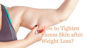 Pin On Weight Loss