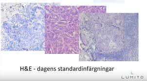 Stockopedia rates lumito ab (publ) as a highly speculative style neutral. Lumito Removes The Haystack And Finds The Needle Immediately Market Worth 8 Billion Usd Redeye Se