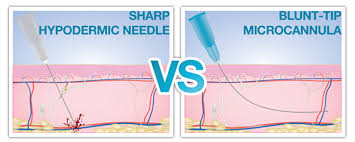 No needle dermal filler training available for non medics. Needle Vs Cannula