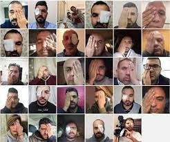 During a visit to the scene near mount meron on friday. Journalists Stand In Solidarity With Palestinian Photographer Shot In The Eye Mondoweiss