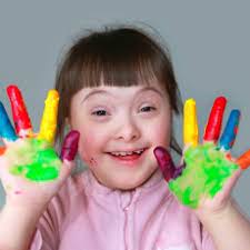 Down Syndrome Medlineplus