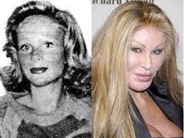 She is still not satisfied and improving her looks. Jocelyn Wildenstien Aka The Cat Woman She Was Pretty Before Celebrity Plastic Surgery Plastic Surgery Actress Without Makeup