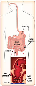 Treatments For Fecal Incontinence Effective Health Care Program