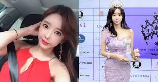 피해자는 폭행 배후로 평소 알고 지내던 한 여배우를 지목했습니다. Jbys2jreghs Am