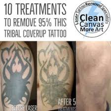 Being stuck with a tattoo that you don't like can be a nightmare. The Best 10 Tattoo Removal Near New York Ny 10011 Last Updated July 2021 Yelp