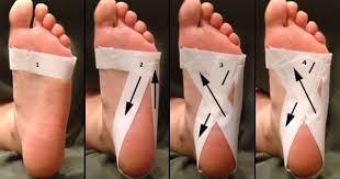 Foot Taping For Plantar Fasciitis Wrap Strip Around Foot At Level Of Ball Of Foot 2nd Plantar Fasciitis Taping Plantar Fasciitis Plantar Fasciitis Treatment