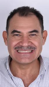 Prototipos , Todo tratamiento estético que involucra aumento de dimensión  vertical debe ser evaluado previamente en boca, mediante mockups o  prototipos funcionales que nos permitan analizar la ...