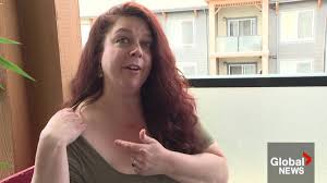 Breast Reduction Results | American Society Of Plastic Surgeons