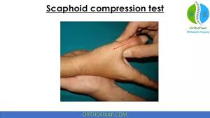 Image result for Scaphoid Shift Test