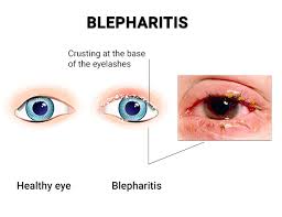 Image result for Blepharis bainesii