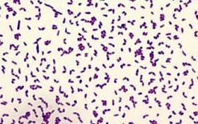 Image result for Rhodococcus equi