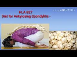 Hla B27 Ke Lie Diet Kya Le Diet Healthy Eating For Ankylosing Spondylitis