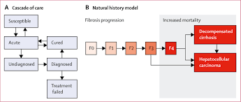 Scaling Up Prevention And Treatment Towards The Elimination Of Hepatitis C A Global Mathematical Model The Lancet