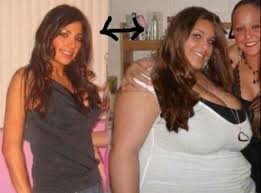 Pin On Before And After