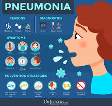 Pneumonia Causes Symptoms Support Strategies Drjockers Com Pneumonia Symptoms Pneumonia Chest Infection Remedies